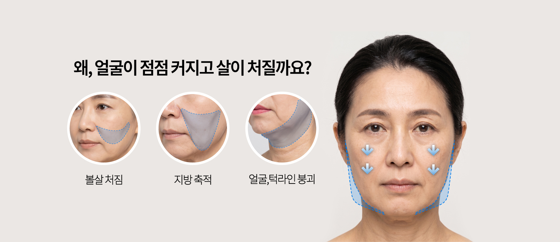 리뉴비온 미니거상술